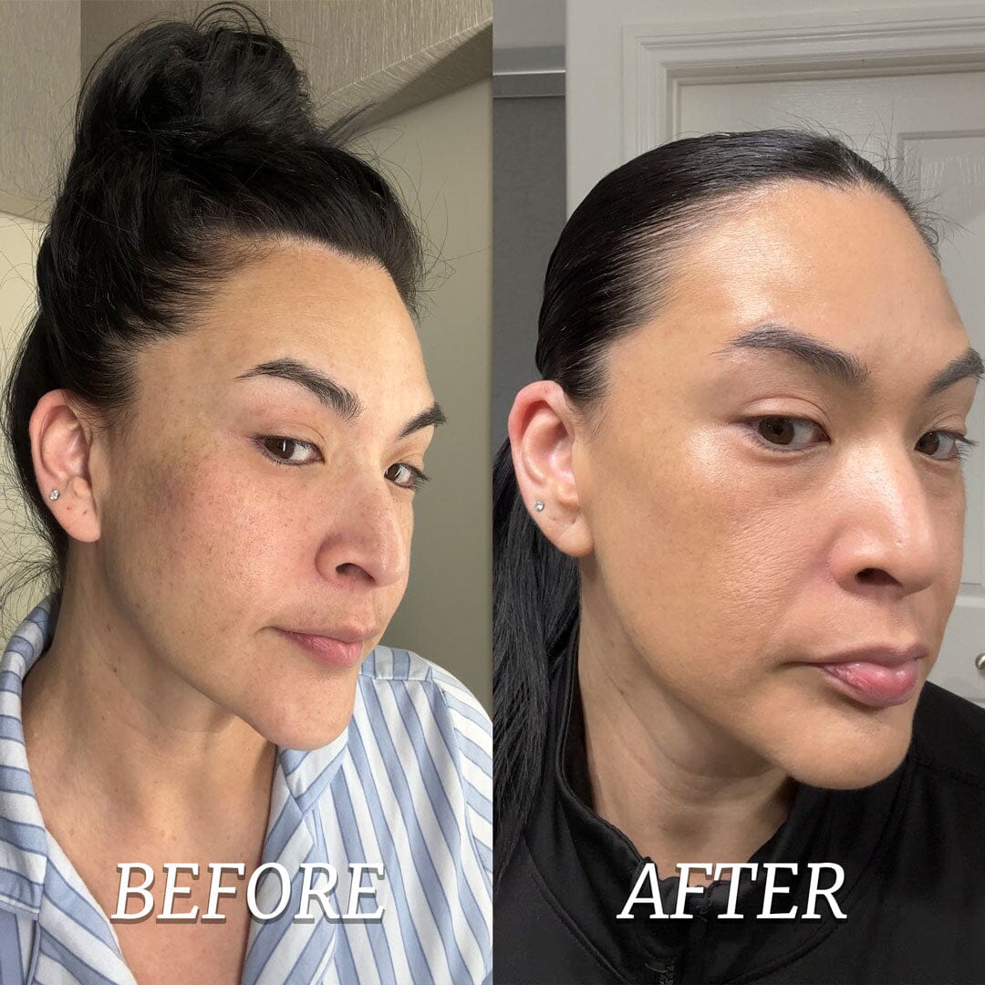 TonEQ: ANTI-PIGMENTATION SUPPLEMENT with 100% NATURAL ACTIVES for EVEN-TONED, CLEAR & GLOWING SKIN - Image 4